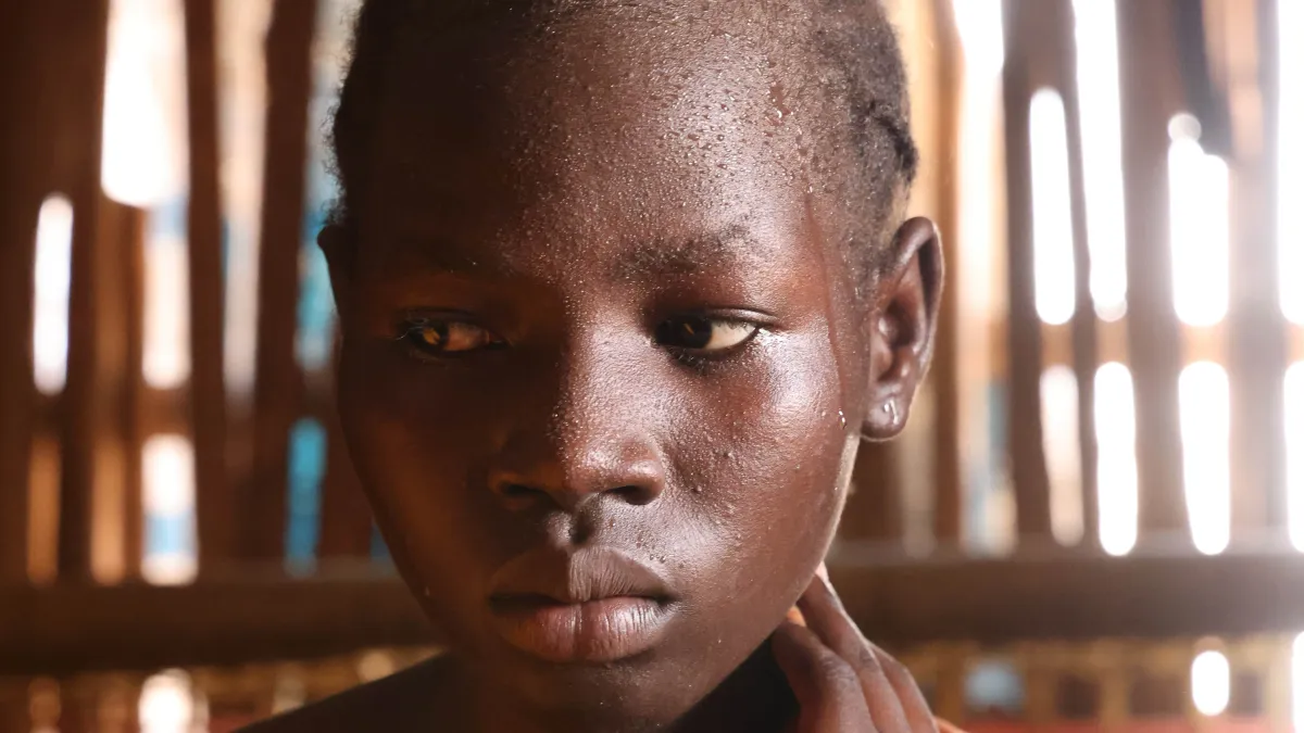 Girl in Mangatheen IDP camp